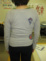 からだ回復整体町田　側彎女性体験談1　腰痛